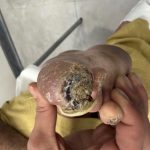 کلینیک هایپربار و زخم تهران در پیروزی