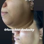 کلینیک زیبایی و پوست نچرال در آمل