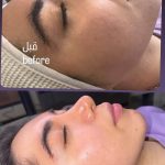 کلینیک زیبایی و پوست نچرال در آمل