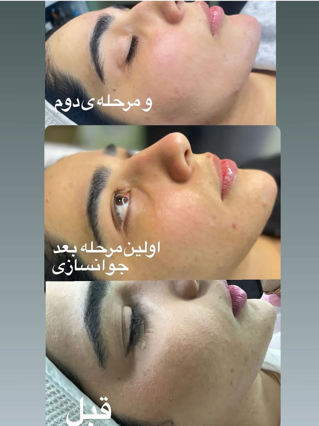 جوانسازی پوست نچرال آمل-- مشاغل ممتاز