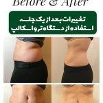 مرکز لاغری و رژیم درمانی پریسا پیراحمدیان شیراز