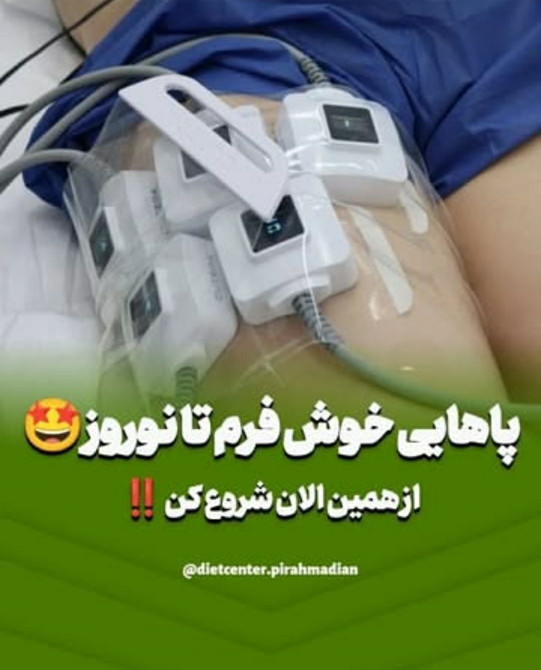 مراحل انجام لاغری با دستگاه ترو اسکالپ ID در شیراز-مشاغل ممتاز