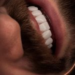 متخصص ترمیمی و زیبایی دندان دکتر فرانک یاری