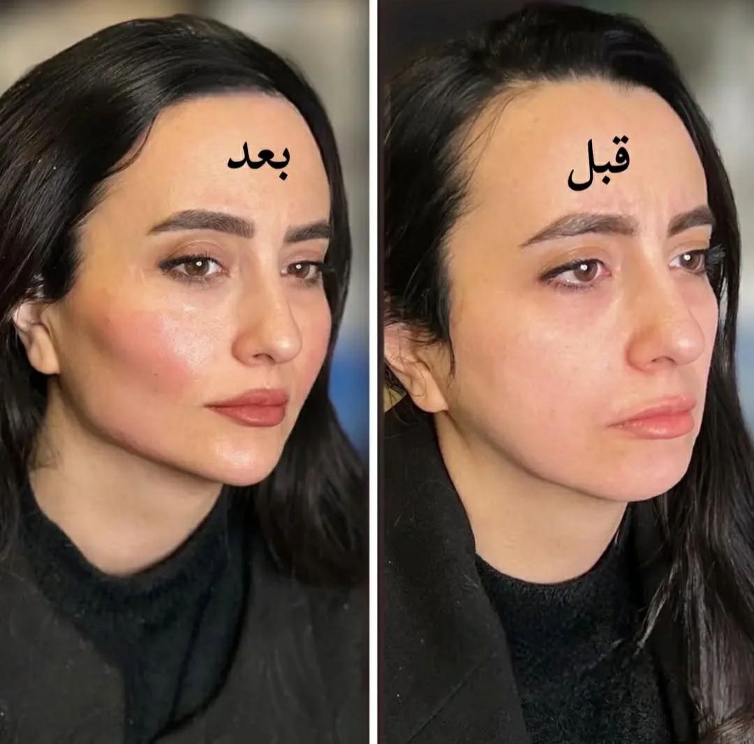 مشاوره رایگان زیبایی و بررسی تناسب چهره توسط تیم مرکز مهسا زمرد -مشاغل ممتاز