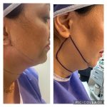 مطب زیبایی دکتر نلسا اصفهان
