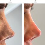 مطب زیبایی دکتر نلسا اصفهان