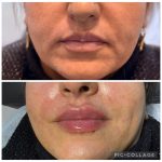 مطب زیبایی دکتر نلسا اصفهان