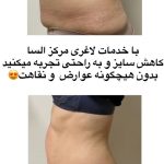 کلینیک لاغری و تناسب اندام السا در کرمانشاه