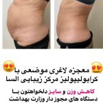 کلینیک لاغری و تناسب اندام السا در کرمانشاه