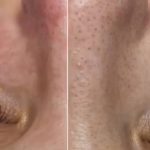 آموزش خدمات فیشال پوست مونا واسع زاده در پیروزی تهران