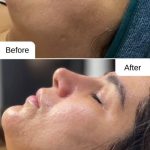 آموزش خدمات فیشال پوست مونا واسع زاده در پیروزی تهران