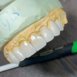 لابراتوار دندانسازی کیا در شیراز