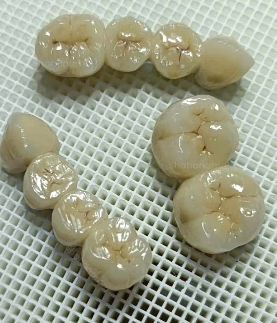  تیم متخصص و باتجربه لابراتوار دندانسازی کیا در شیراز آماده همکاری با دندان‌پزشکان _مشاغل ممتاز