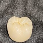 لابراتوار دندانسازی کیا در شیراز