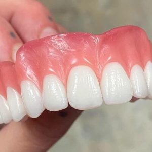 لابراتوار دندانسازی کیا در شیراز مرکز تخصصی ساخت انواع پروتزهای ثابت و متحرک _مشاغل ممتاز