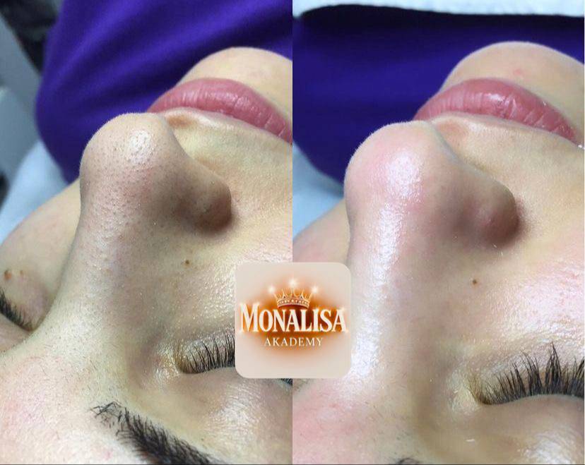 کلاس‌های آموزش تخصصی خدمات فیشال و جوانسازی پوست مونا واسع زاده محدوده پیروزی تهران_مشاغل ممتاز
