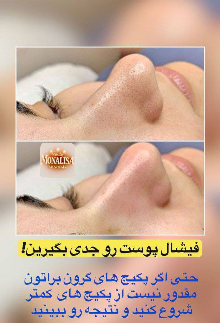 ثبت نام دوره ویژه آموزش خدمات فیشال پوست کلینیک مونا واسع زاده در خیابان پیروزی تهران_مشاغل ممتاز