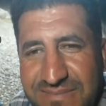 کاشت مو و ابرو محیا شهیدی در شیراز