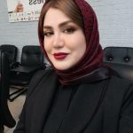 کاشت مو و ابرو محیا شهیدی در شیراز