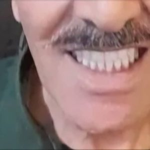 ساخت تخصصی روکش زیرکونیا در لابراتوار دندانسازی ماهر کرمان_مشاغل ممتاز