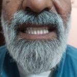 لابراتوار دندانسازی ماهر در کرمان